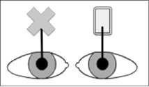 両眼視機能異常のイメージイラスト